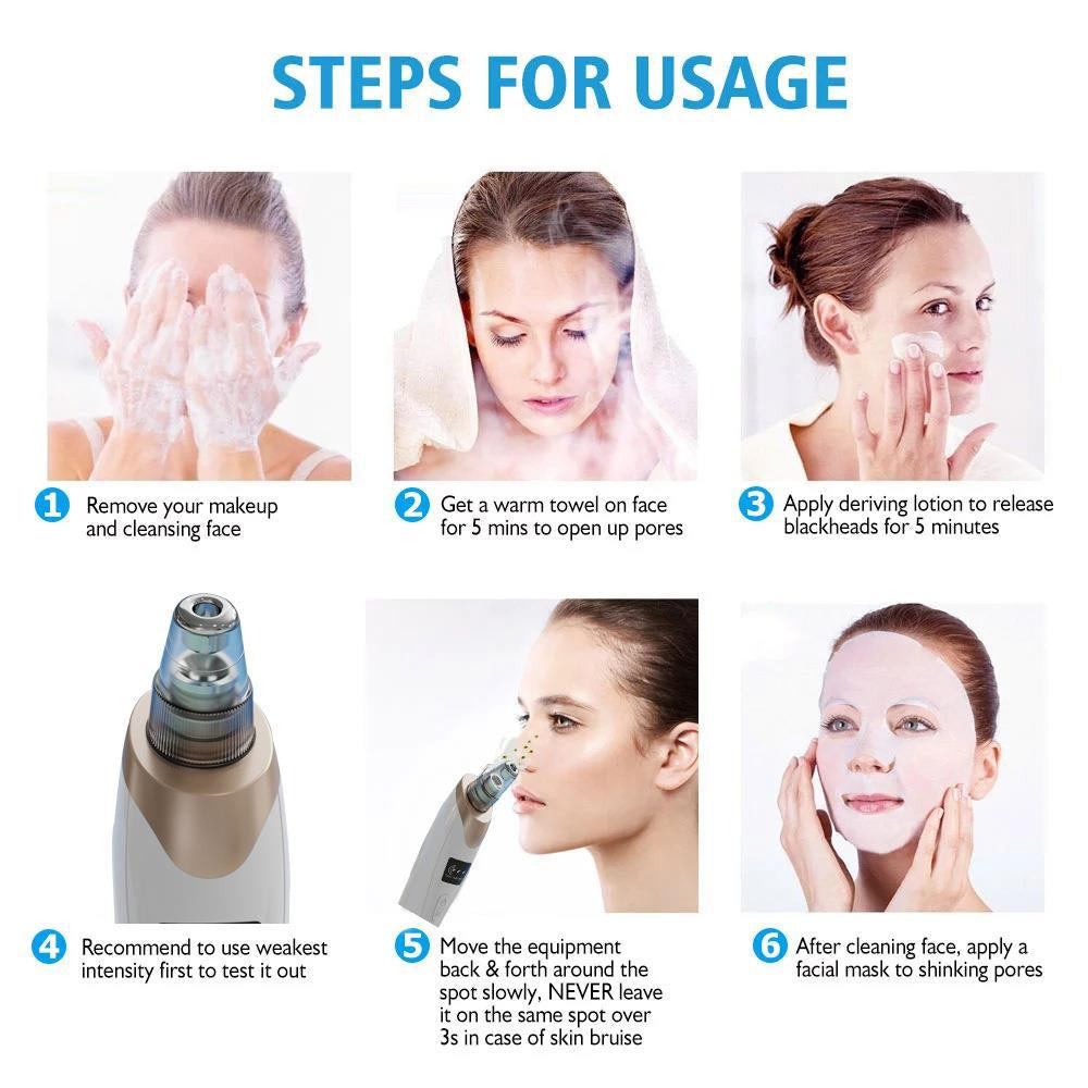 5 in 1 Blackhead Vacuum Cleaner – Instantly Remove Blackheads at Home
